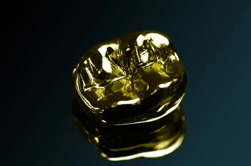 Full gold crown