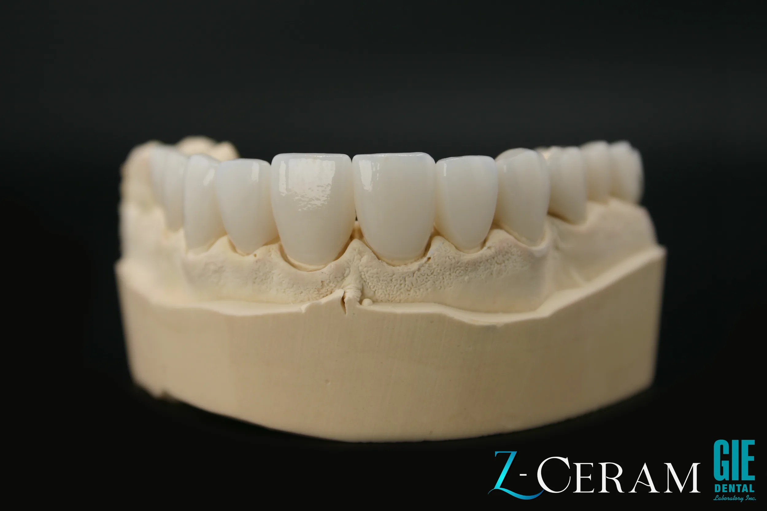 Layered zirconia upper restoration