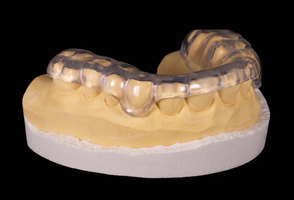 Custom milled nightguard / occlusal guard