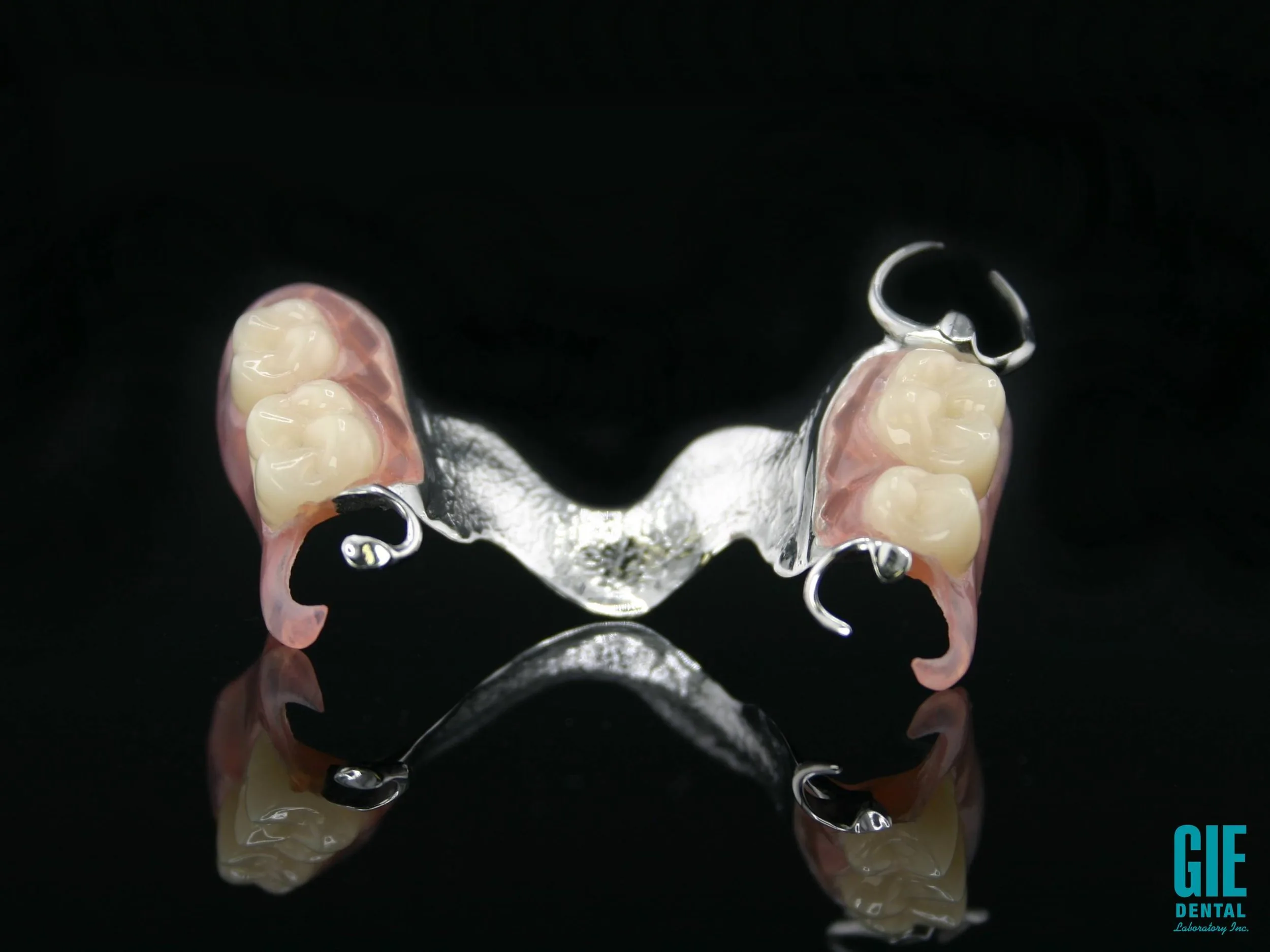 Chrome cobalt hybrid partial denture