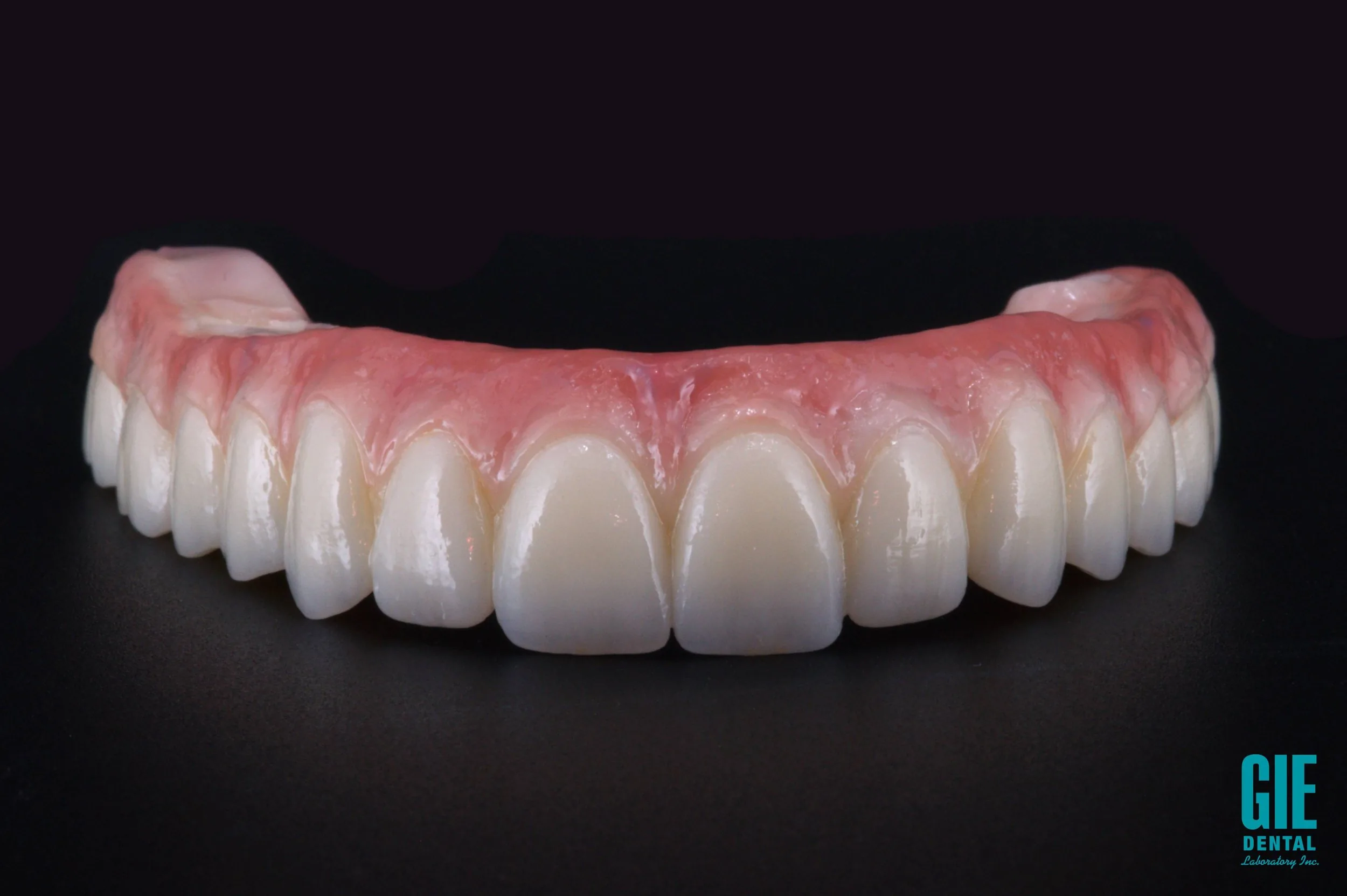 Full-zirconia implant bridge